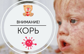 Внимание корь!